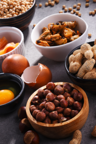 Alergias e Intolerancias Alimentarias Alergias e Intolerancias Alimentarias